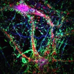 Tiny brain nanotubes found by Johns Hopkins may spread Alzheimer’s